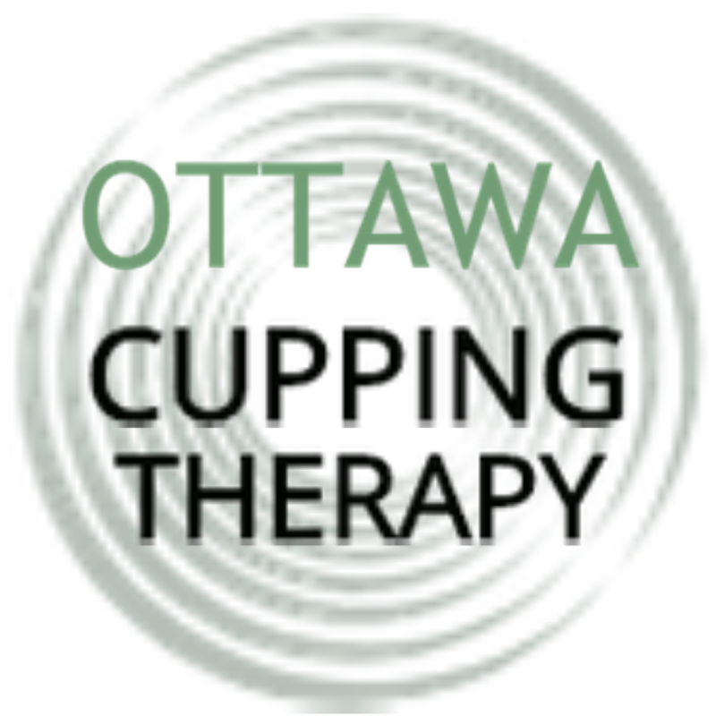 Ottawa Cupping Therapy (Hijama)